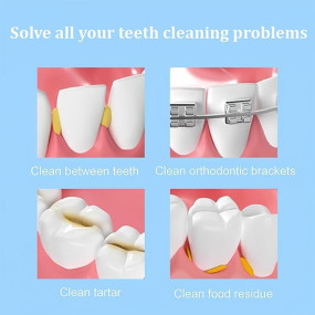 Pivdo 10 Pcs Interdental Brush for Teeth Cleaning Kit Tools Proxa Tooth Brush Cleaner for Tight Teeth - Soft Bristled Dental Picks for Plaque Removal & Gum Health